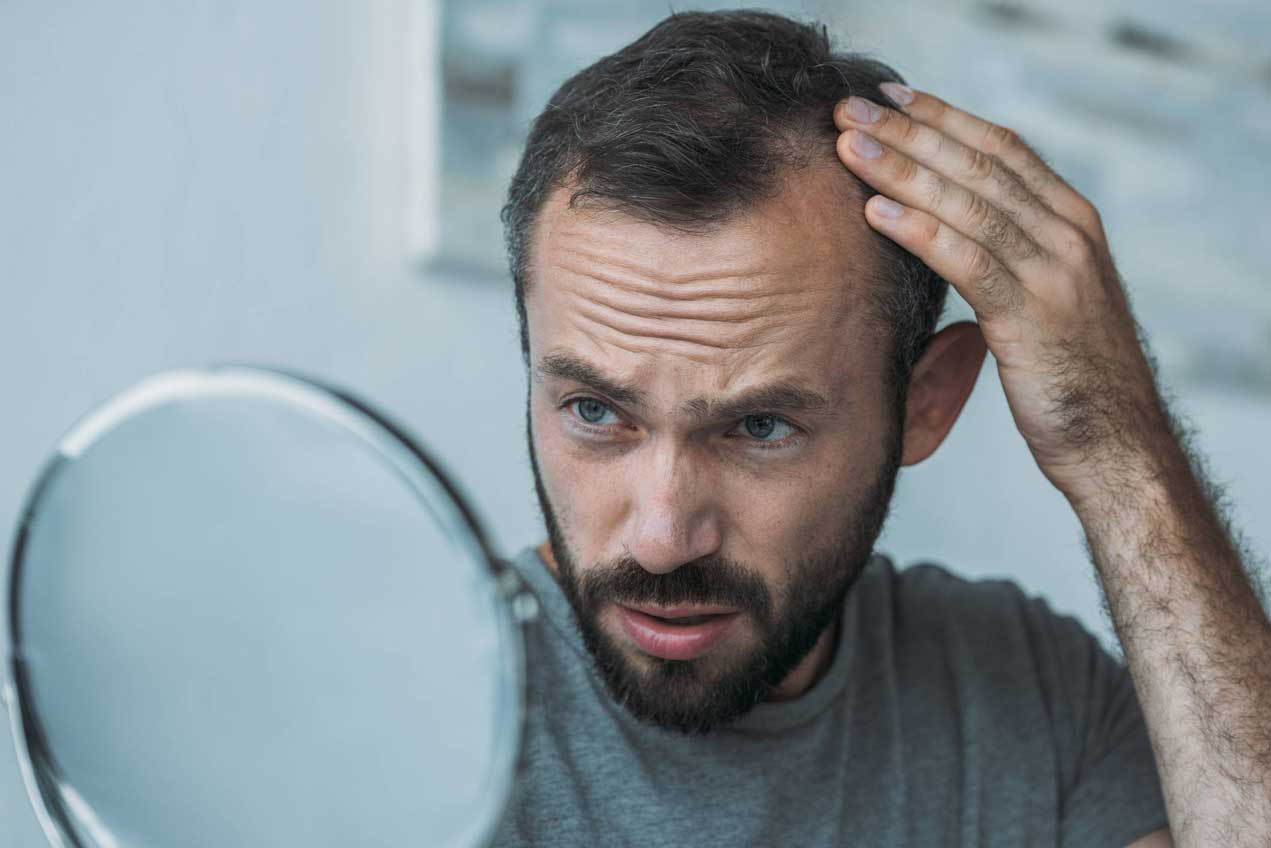 how to regain hair loss from stress